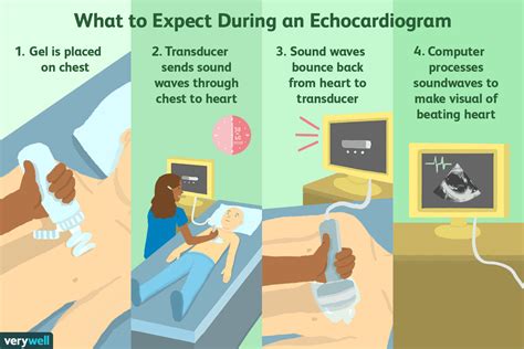 what is 2d echocardiogram with doppler|Types of Echocardiogram Tests and What to Expect.